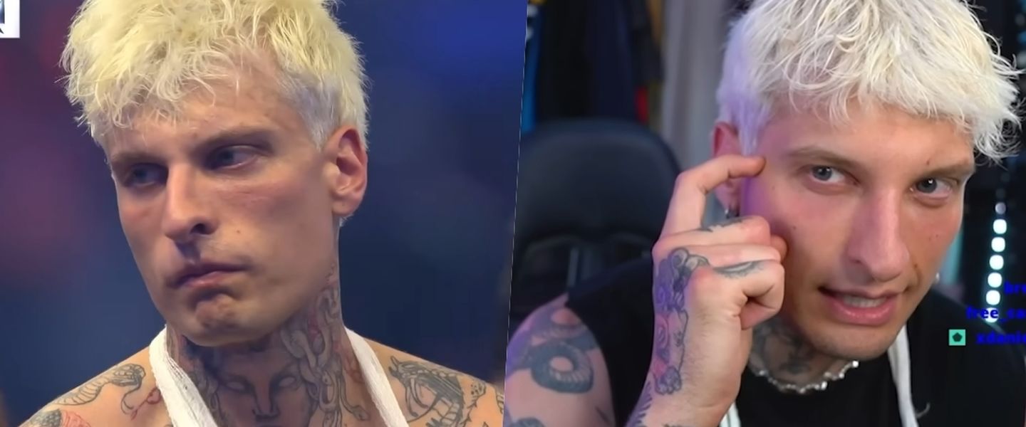 Misho: el antes y un después de una fatídica lesión