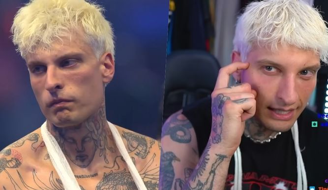 Misho: el antes y un después de una fatídica lesión