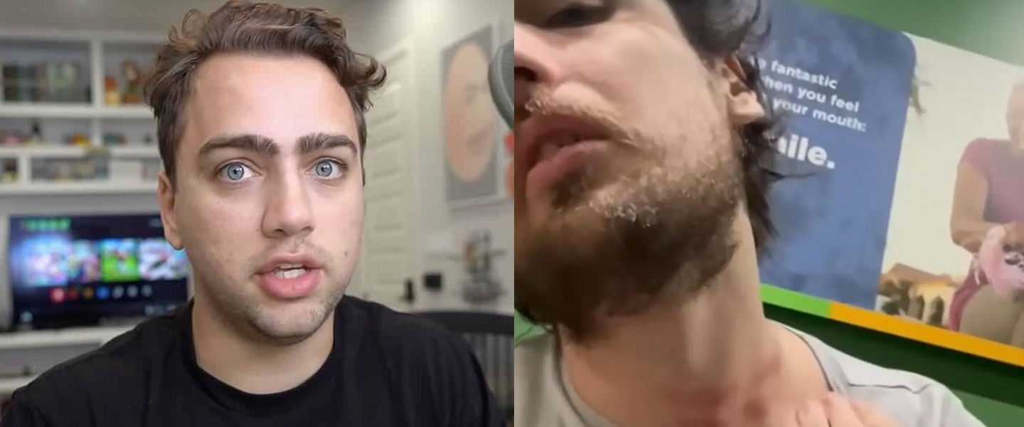 Mitch Jones expone la agresión que sufrió por parte de Mizkif